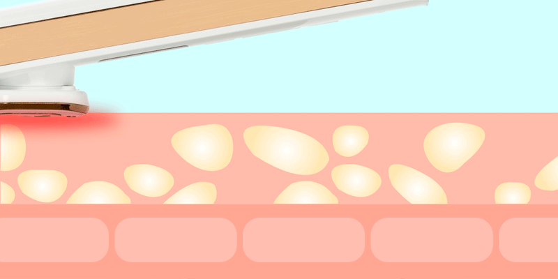 LED Light Care Wand